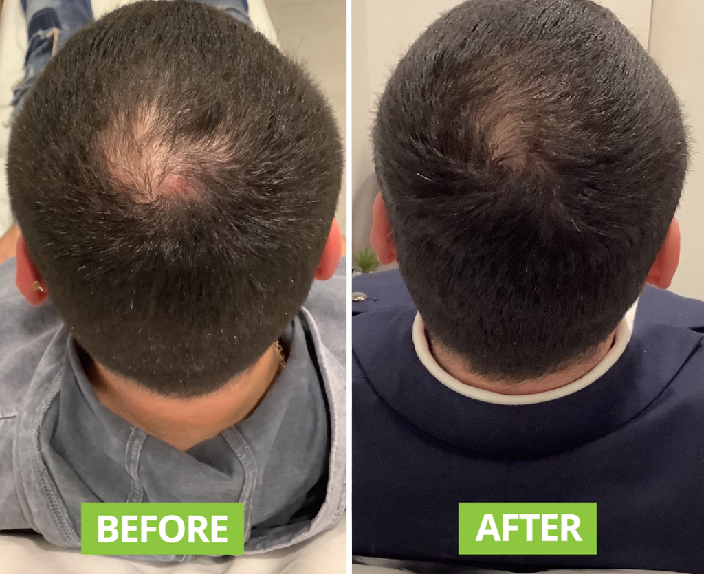 ROSEMARY & CLOVE HAIR & SCALP OIL