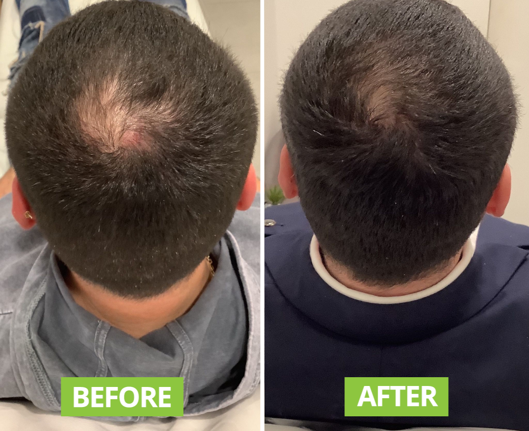 ROSEMARY & CLOVE HAIR & SCALP OIL