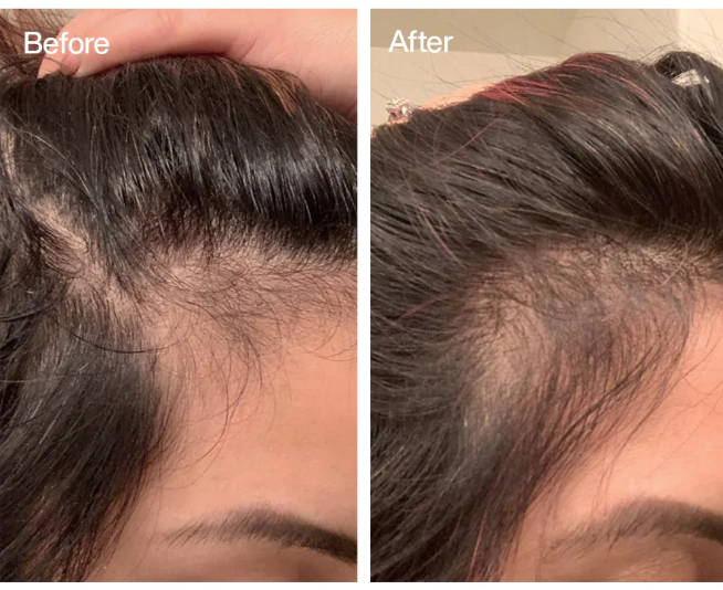 ROSEMARY & CLOVE HAIR OIL